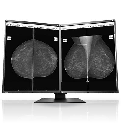 Buy EIZO RadiForce GX560 5MP Grayscale Mammography Monitor