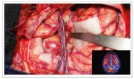 EIZO CuratOR 4K surgical display family