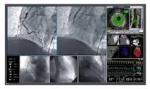 EIZO CuratOR LL550W cath lab monitor