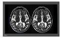 EIZO CuratOR LX3240-MR MRI compatible monitor