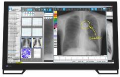 EIZO MS236WT-A medical touch display