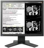 EIZO RadiForce MX194 clinical reporting monitor