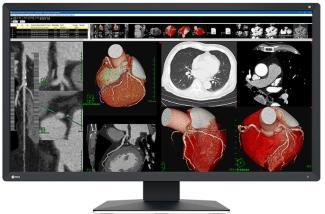 EIZO RadiForce MX317W 8MP clinical reporting monitor