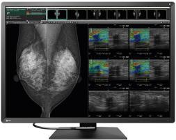 EIZO RadiForce RX1270 12MP diagnostic monitor