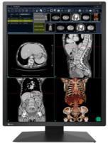 EIZO RadiForce RX270 2MP diagnostic monitor