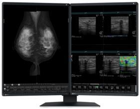 EIZO RadiForce RX570 5MP diagnostic monitor