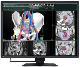 EIZO RadiForce RX670 6MP diagnostic monitor