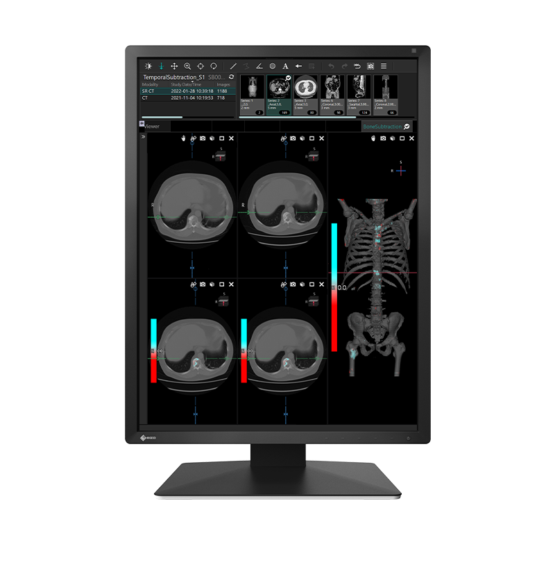 Buy EIZO RadiForce MX217 2MP Color Clinical Review Monitor