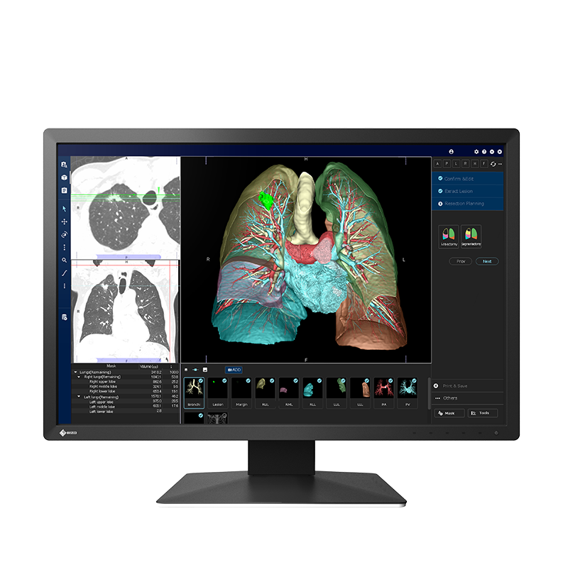 Buy EIZO RadiForce MX243W 2MP HIS/RIS Clinical Monitor
