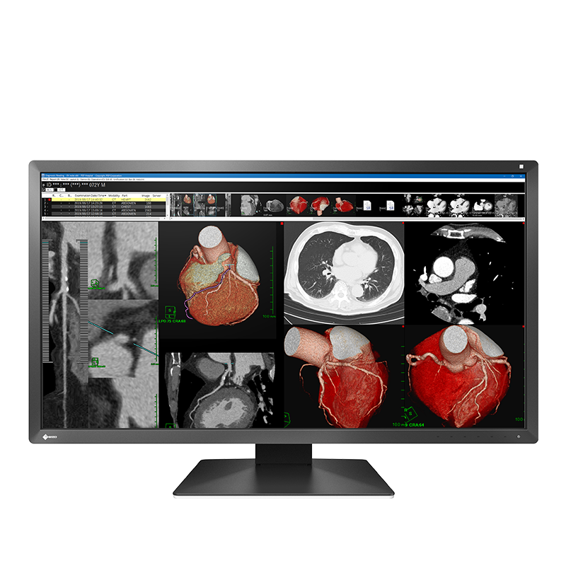 Buy EIZO RadiForce RX350 Clinical Review Monitor Display