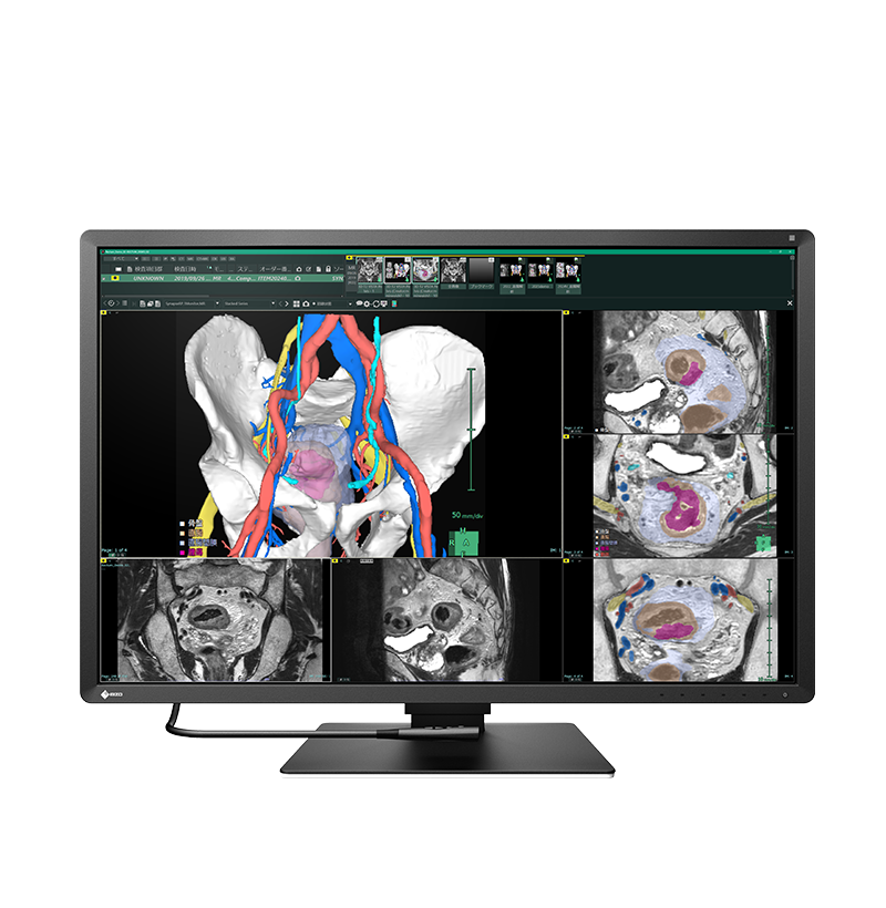 Buy EIZO RadiForce RX670 Diagnostic Monitor - Radiology Ecosystem India