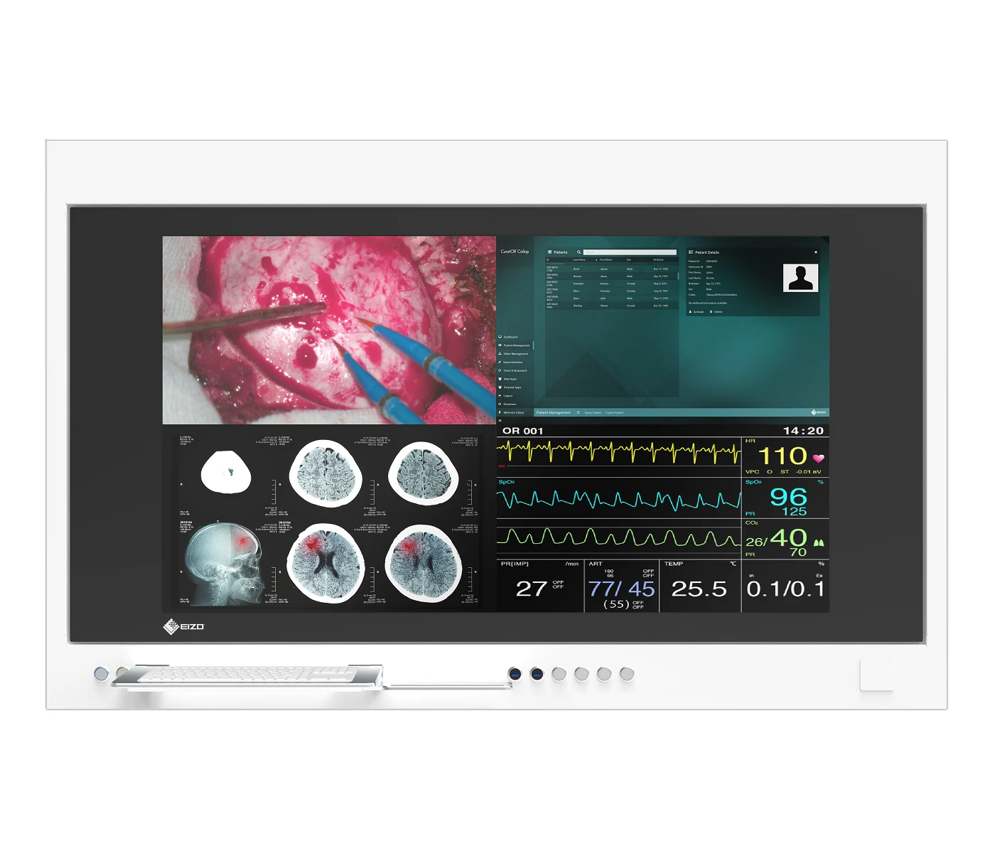 Buy EIZO CuratOR SP1-554K 4K Operating Room Surgical Wall Panel